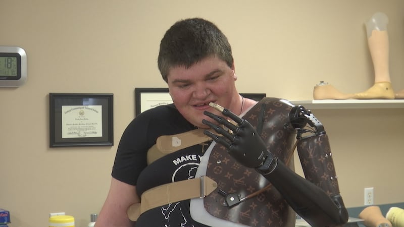 Nick Kelley tries out his new prosthetic are he can control with his mind.
